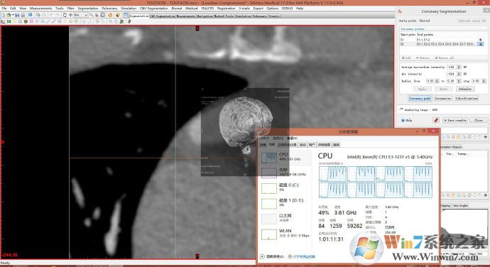 Materialise Mimics(ҽѧͼ�����ݴ���)�����ƽ��