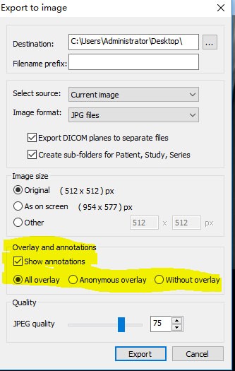 MicroDicom viewer(Dicom��ʽ��ͼ����)
