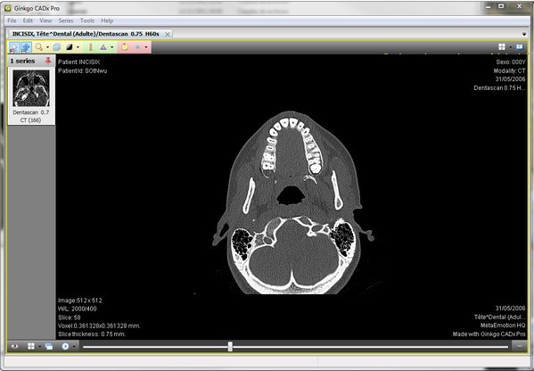 Ginkgo CADx Pro����|ҽѧӰ��鿴���� V3.7.1�ٷ���