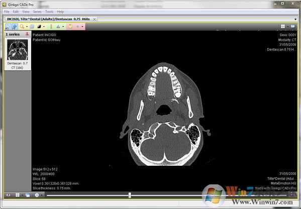 DICOM�����_Ginkgo CADx Pro(dicom��ͼ����)��ɫ��