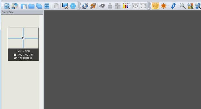 Sante DICOM Viewer Free v6.0��ɫ�ƽ��