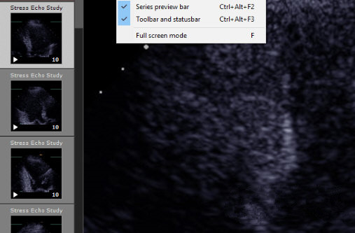 RadiAnt DICOM Viewer(DICOM�����) v5.0.1�ƽ��