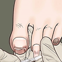 �޽�ģ�����ֻ���